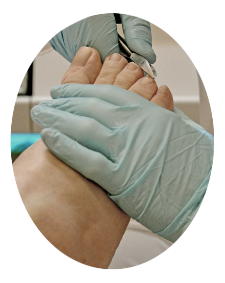  podologo bogota pedicure medicinal milenio 3 consultorio 207
